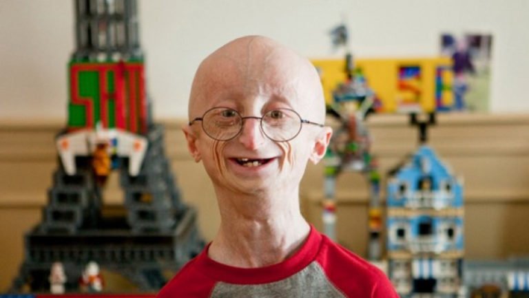 Редкие и необычные заболевания (Часть 2) Редкие и необычные заболевания (Часть 2)