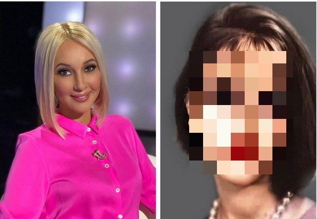Телеведущая Лера Кудрявцева показала, какой была до пластики