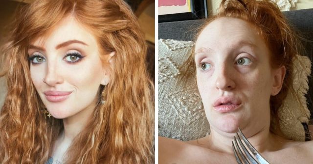 "Из красавицы в чудовище": девушки, которые не стесняются показать себя не в лучшем свете