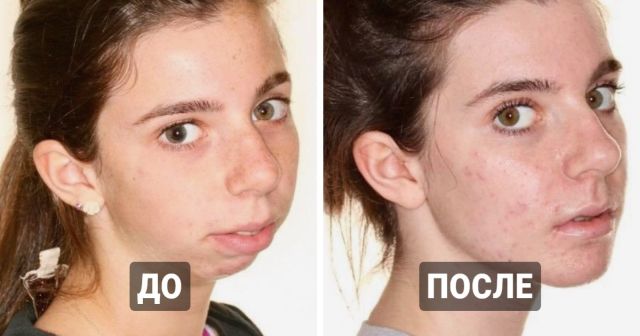 Пластические операции, которые изменили жизнь людей к лучшему