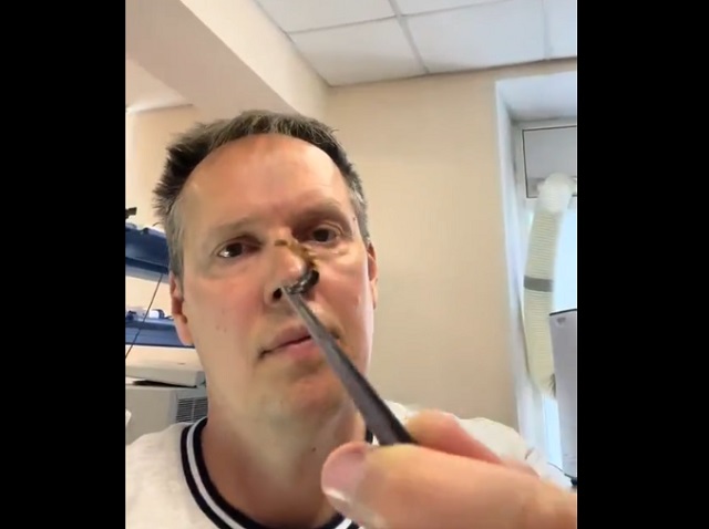 "Разрушитель мифов": правда ли уховертка может прогрызть ухо и залезть в мозг?