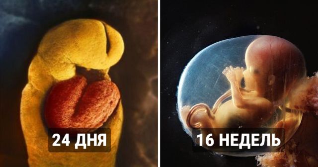 "Чудо рождения": фотограф показал удивительный процесс появления новой жизни на свет