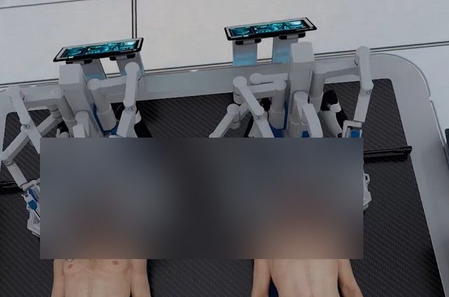 Учёные представили революционную технологию по пересадке головы