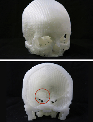 Мужчина спас зрение жены благодаря 3D печати Мужчина спас зрение жены благодаря 3D печати