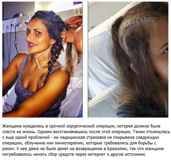 Как улыбка спасла жизнь 30-летней бразильянке