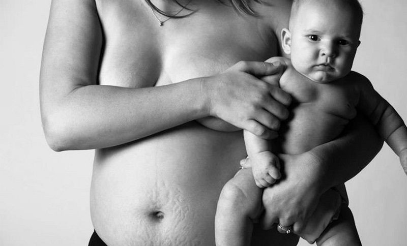 Фотограф показал, что тела женщин после родов выглядят не так, как в модных журналах