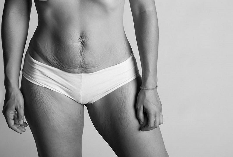 Фотограф показал, что тела женщин после родов выглядят не так, как в модных журналах Фотограф показал, что тела женщин после родов выглядят не так, как в модных журналах