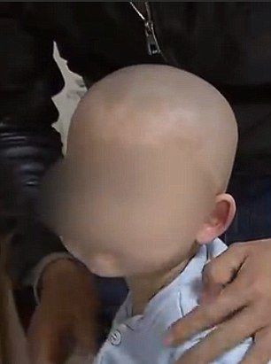 Хирурги ампутировали у младенца третью ногу