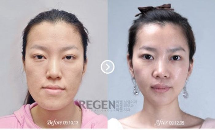 Пластическая хирургия в Корее