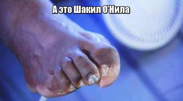 Обратная сторона побед в профессиональном спорте