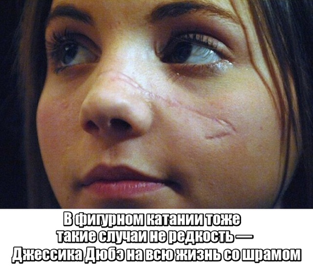 Обратная сторона побед в профессиональном спорте