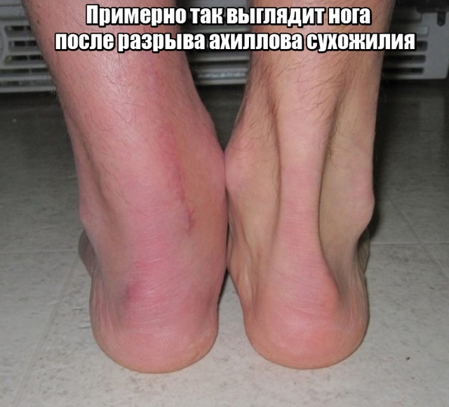 Обратная сторона побед в профессиональном спорте
