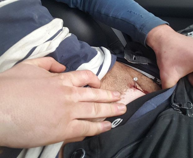 Мужик выстрелил себе в пах из строительного пистолета