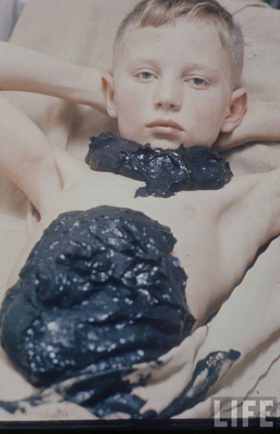 Советская медицина в фотографиях Советская медицина в фотографиях
