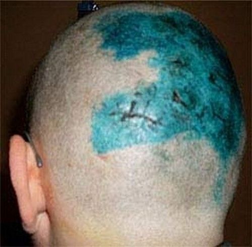 Степу Меньшикова (ДОМ-2) избили