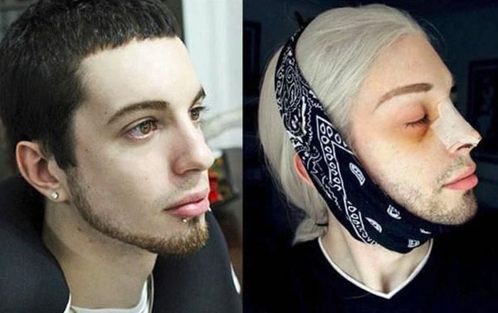 Студент из Аргентины превратил себя в эльфа