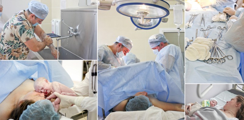 Кесарево сечение своими глазами