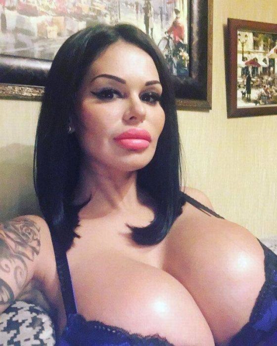 Девушки, которые переборщили с силиконом