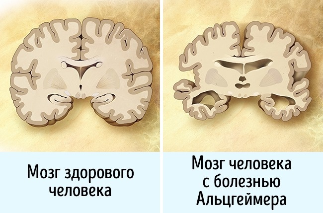 12 неожиданных вещей, которые вредят мозгу