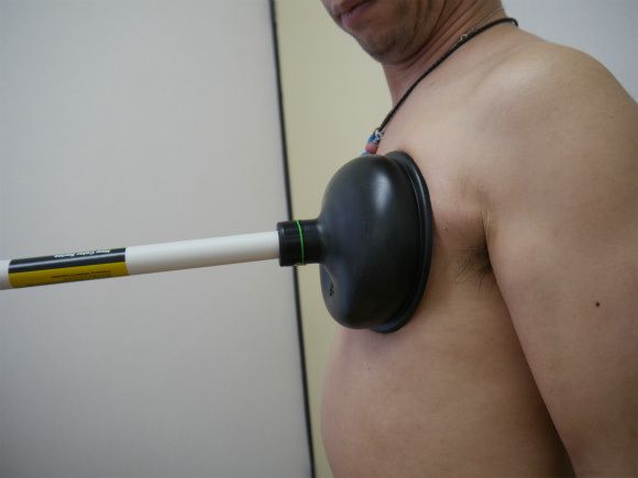 Можно ли увеличить грудь с помощью вантуза