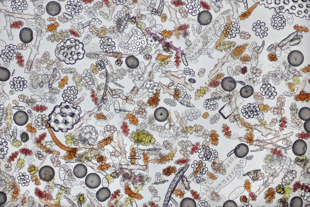 Конкурс микрофотографии Nikon small world 2012 Конкурс микрофотографии Nikon small world 2012