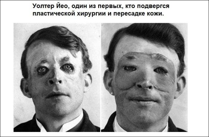 Исторические фотографии